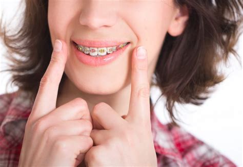 best orthodontist near 10930|3 Best Orthodontists in London, UK